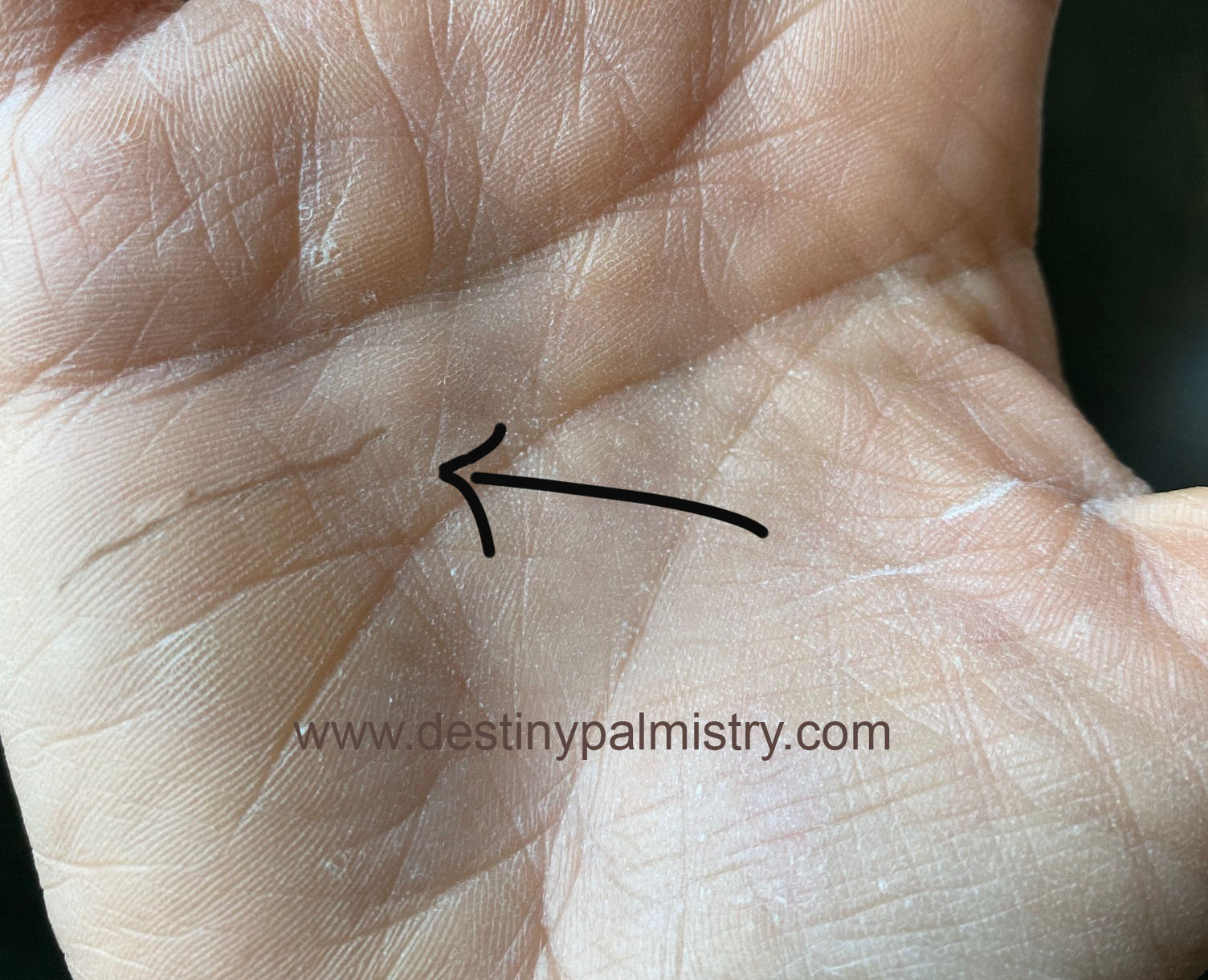 Uncommon Palm Lines and Their Mysterious Meanings