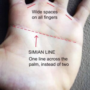 Simian line on palm, know about the Simian line, simina line information, palmistry course online