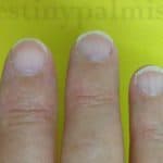 health signs from fingernail, white fingernails, white nails meaning, is white nail bad?