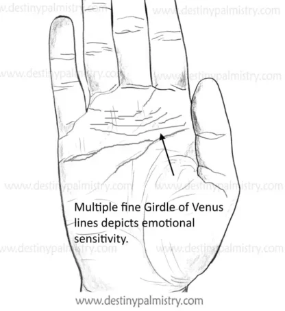 girdle of venus, mirage line