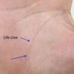 life line types, split life line, life line health warning