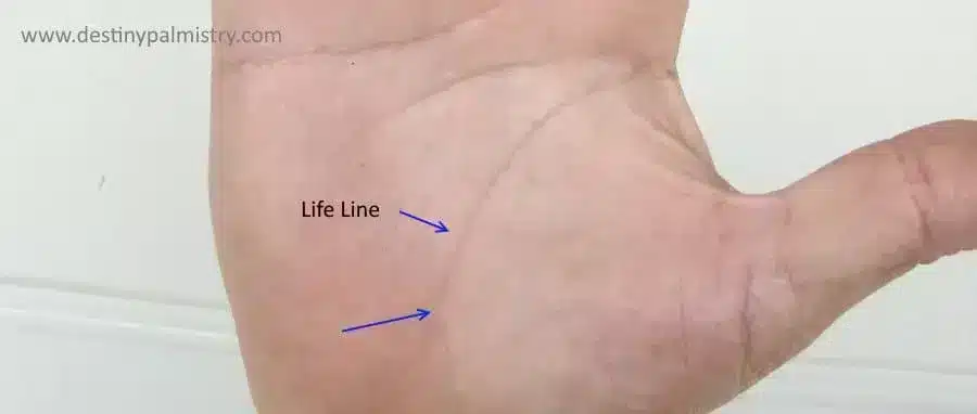 life line types, split life line, life line health warning