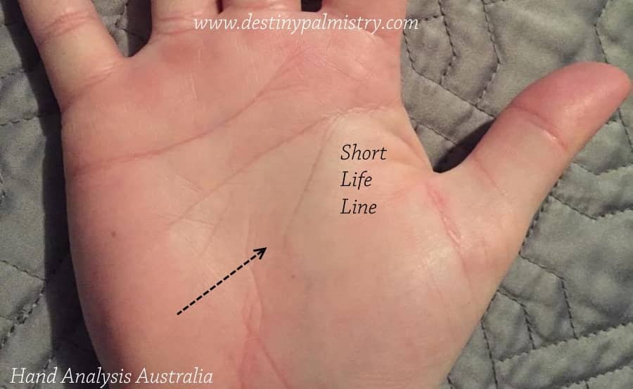 Short Line of Life Actual Meaning in Palmistry
