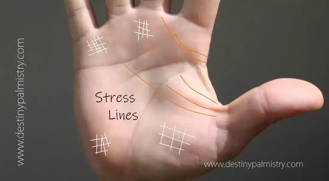 Stress Lines and Trauma Lines on the Palms