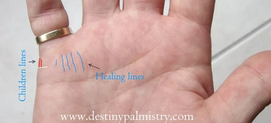 healing lines, children lines, child line on palm, medical stigmata lines, best palm reader in the world