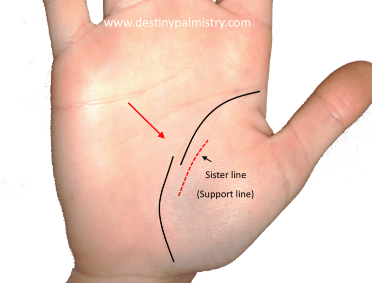 Broken Life Line Meaning in Palm Reading - Destiny Palmistry