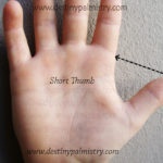 short thumb