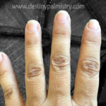 fingernail shape