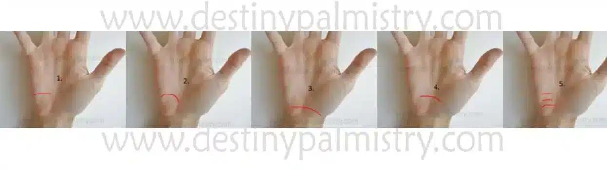 Allergy line, palm line
