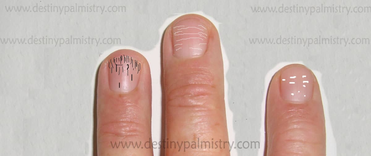 Fingernail Ridges, and the Meaning of Spots and Lines - Destiny Palmistry